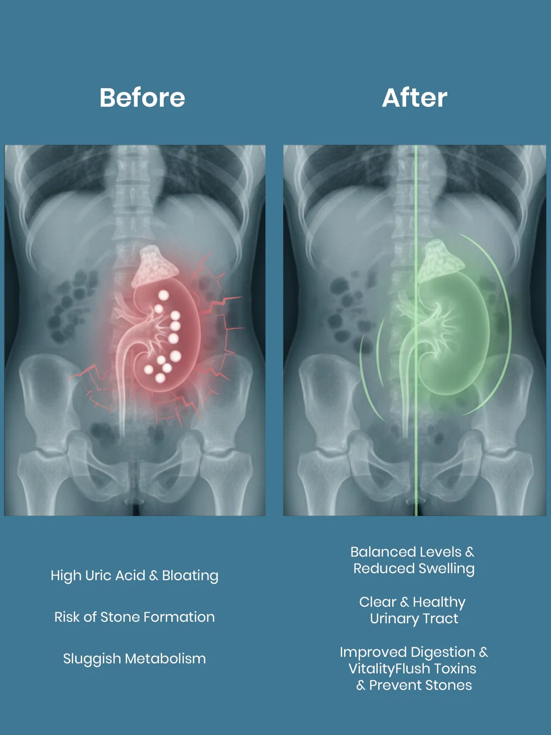 Kidney Care Juice